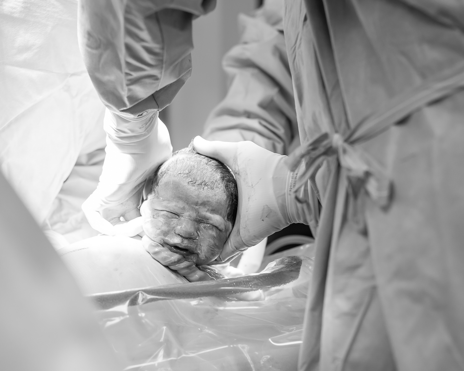 Csection Statistics & Facts